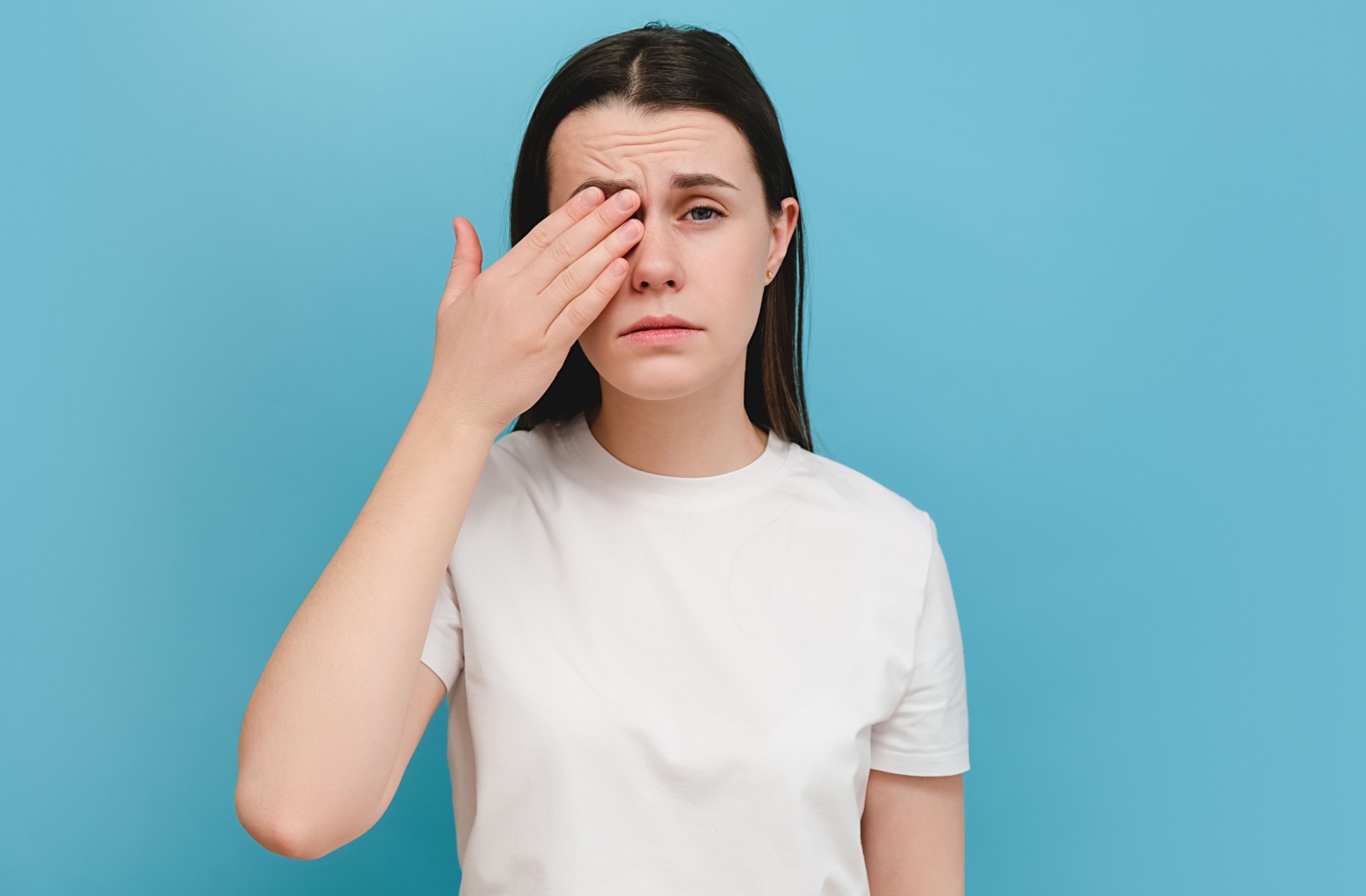 A person covering their right eye with their hand while the left eye shows signs of irritation.